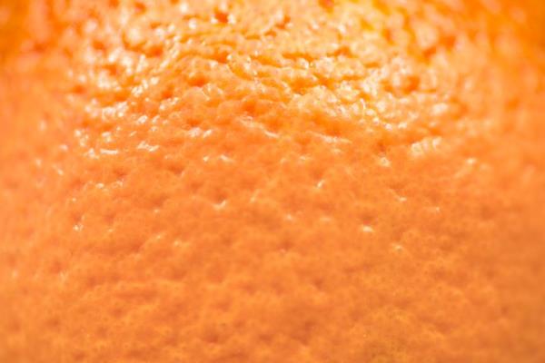 Comparisons are often made between orange peels and the appearance of cellulite.